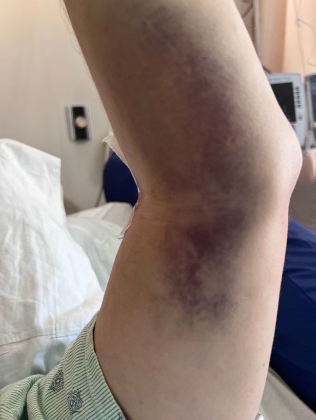 DFB65D64-B6F5-4227-B7E7-E1B533DC4B1B_1_105_c